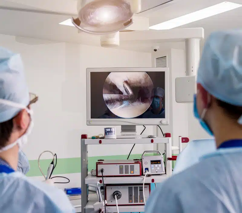 Doctors Monitoring An Arthroscopic Procedure.