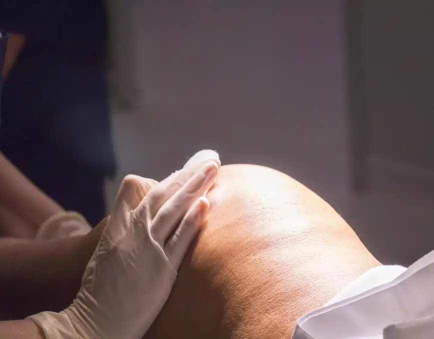 Medical professional holding an arthroscope during a knee examination.